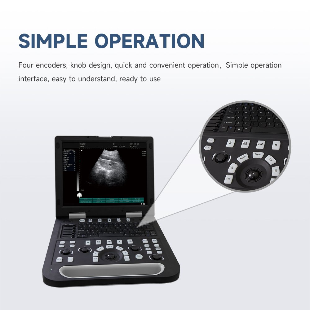 B-ultrasonic portable color doppler digital ultrasound machine diagnostic ultrasound equipment Support custom