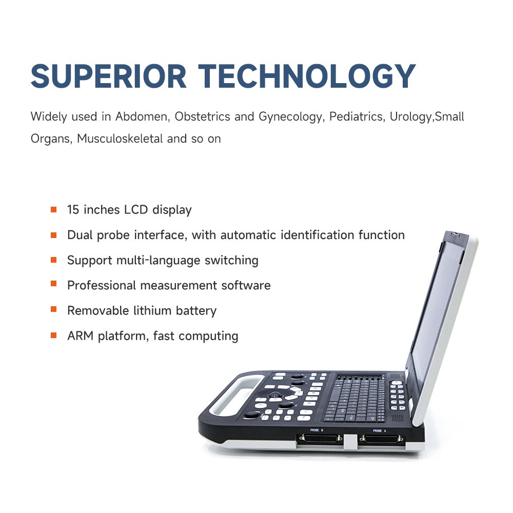 B-ultrasonic portable color doppler digital ultrasound machine diagnostic ultrasound equipment Support custom