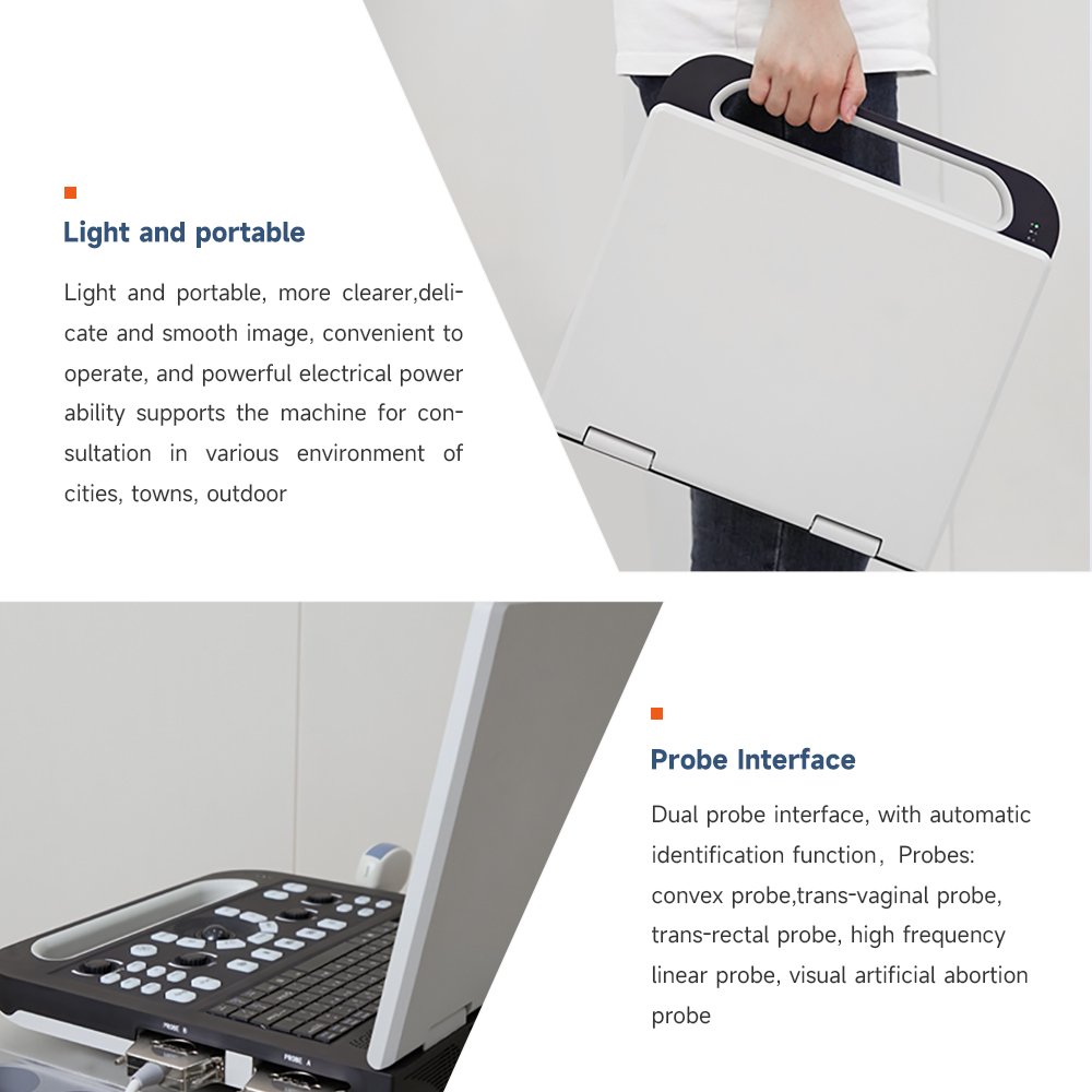 B-ultrasonic portable color doppler digital ultrasound machine diagnostic ultrasound equipment Support custom