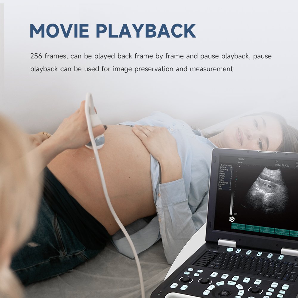 B-ultrasonic portable color doppler digital ultrasound machine diagnostic ultrasound equipment Support custom