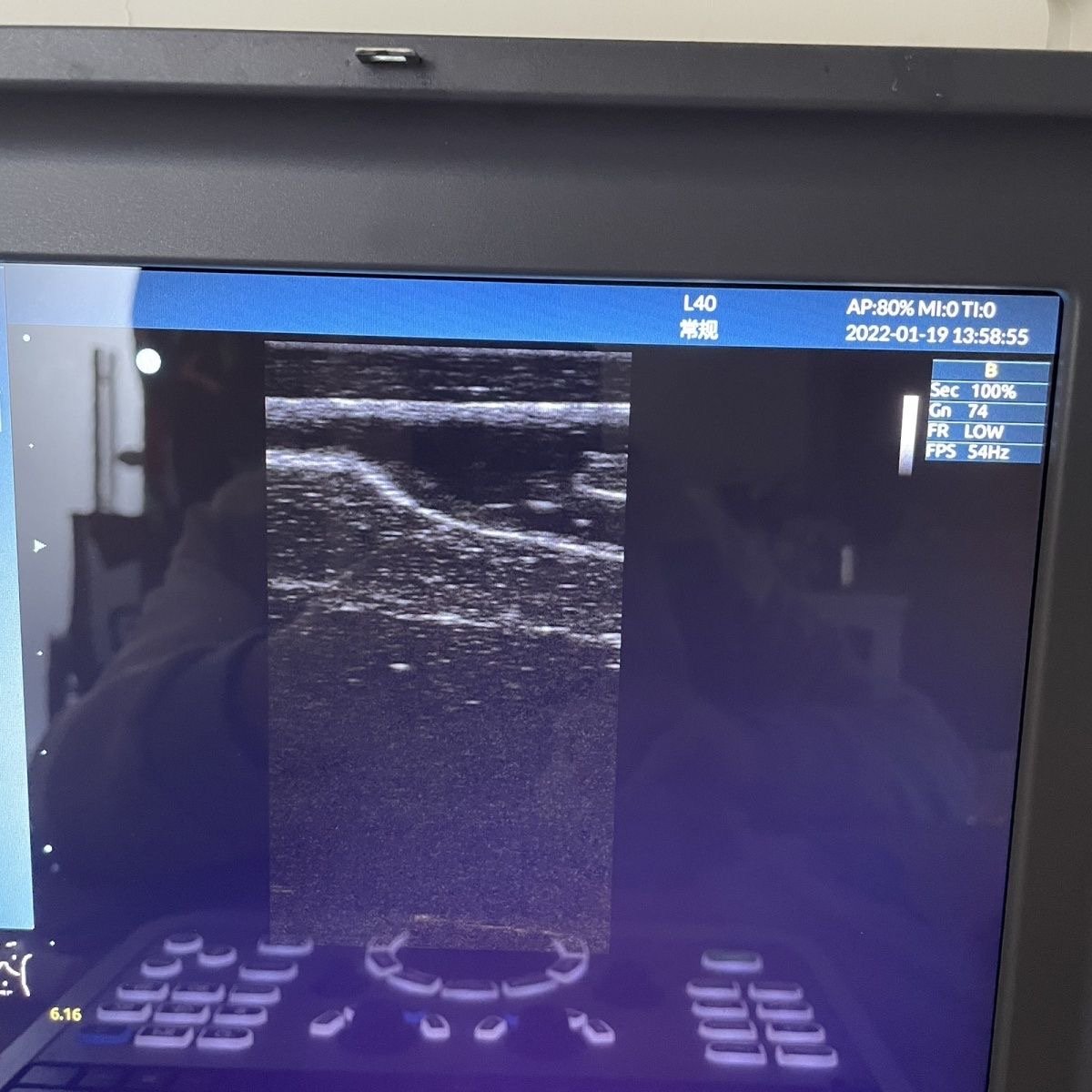KyrenMed Ultrasound Guided Branching Vascular Puncture Model PICC Puncture Training Module with Circulation Pump