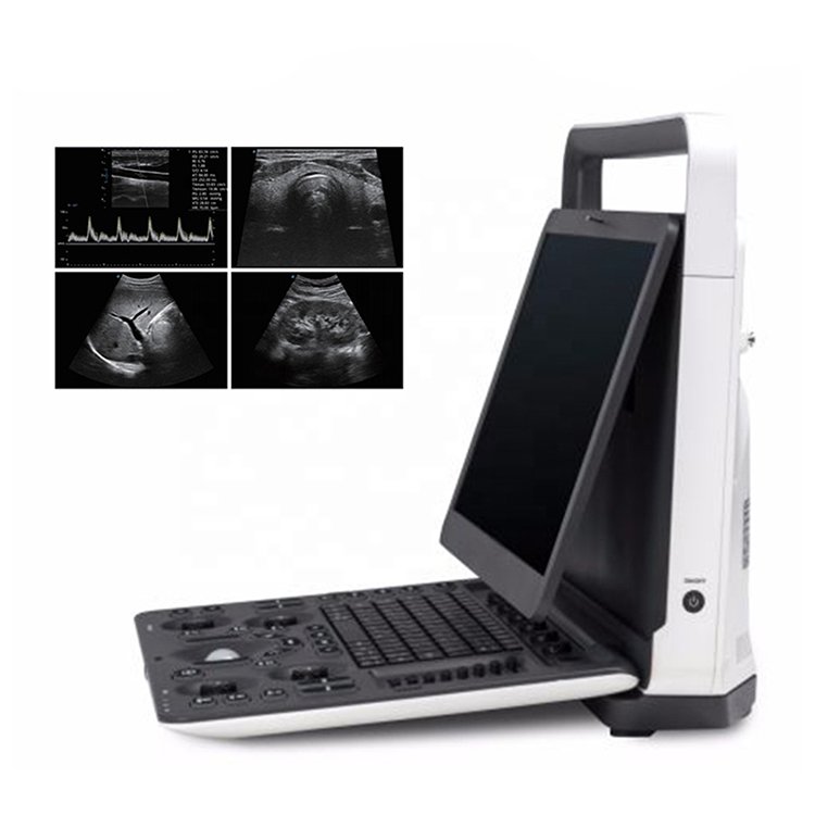SonoScape E2 Laptop Color Doppler Ultrasound machine, SonoScape Ultrasound for sale