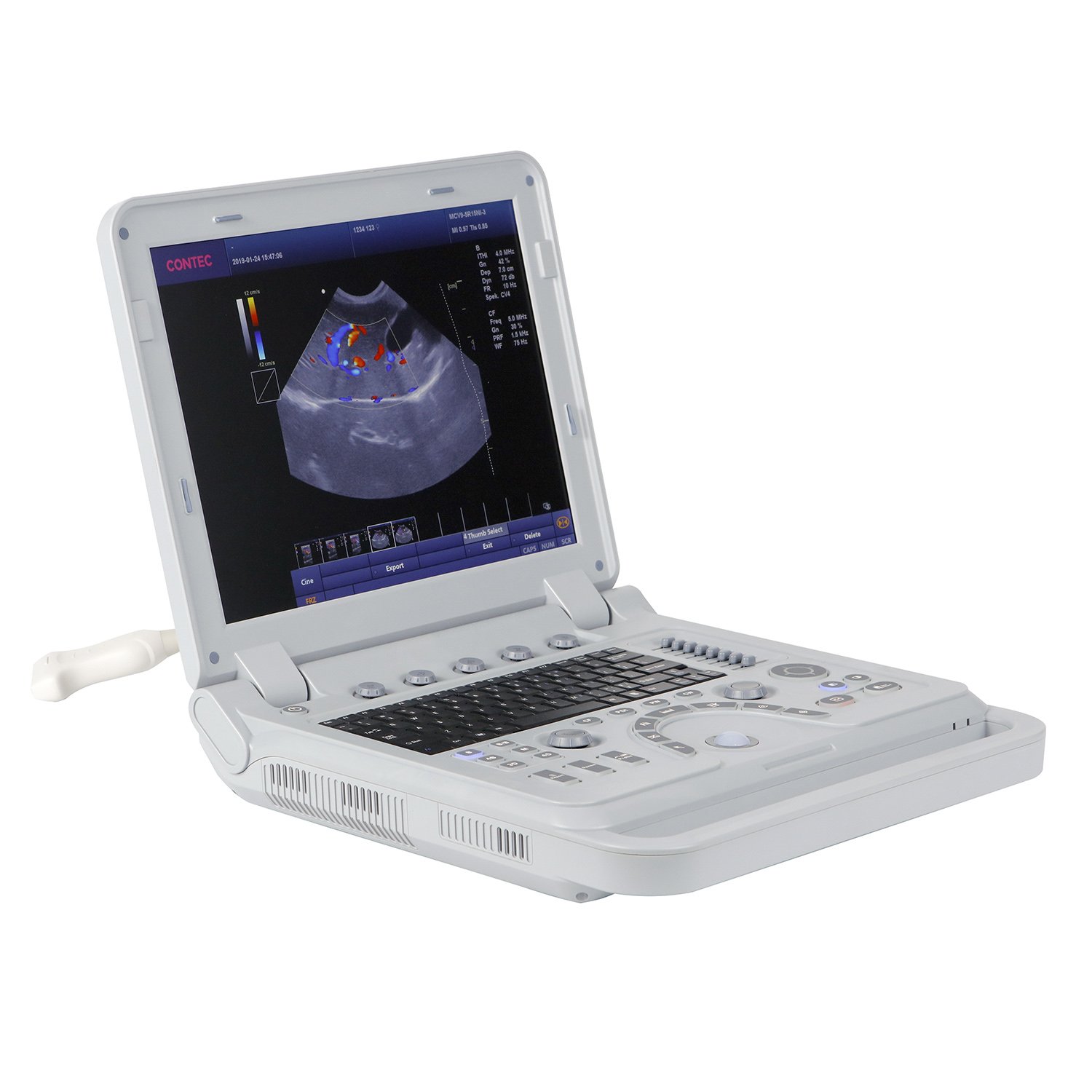 CONTEC CMS1700B portable ultrasound machine color doppler medical ultrasound instruments