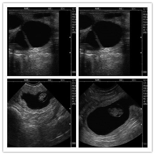 Wireless Veterinary Ultrasound Rectal Probe 6.5-8Mhz For Reproductive Diagnostic In Cows And Mares Konted C10EQ