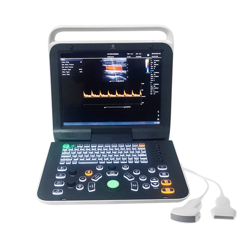 Ultrasound trolley 4D Color Doppler sonography machine portable ultrasound portable ultrasound machine price