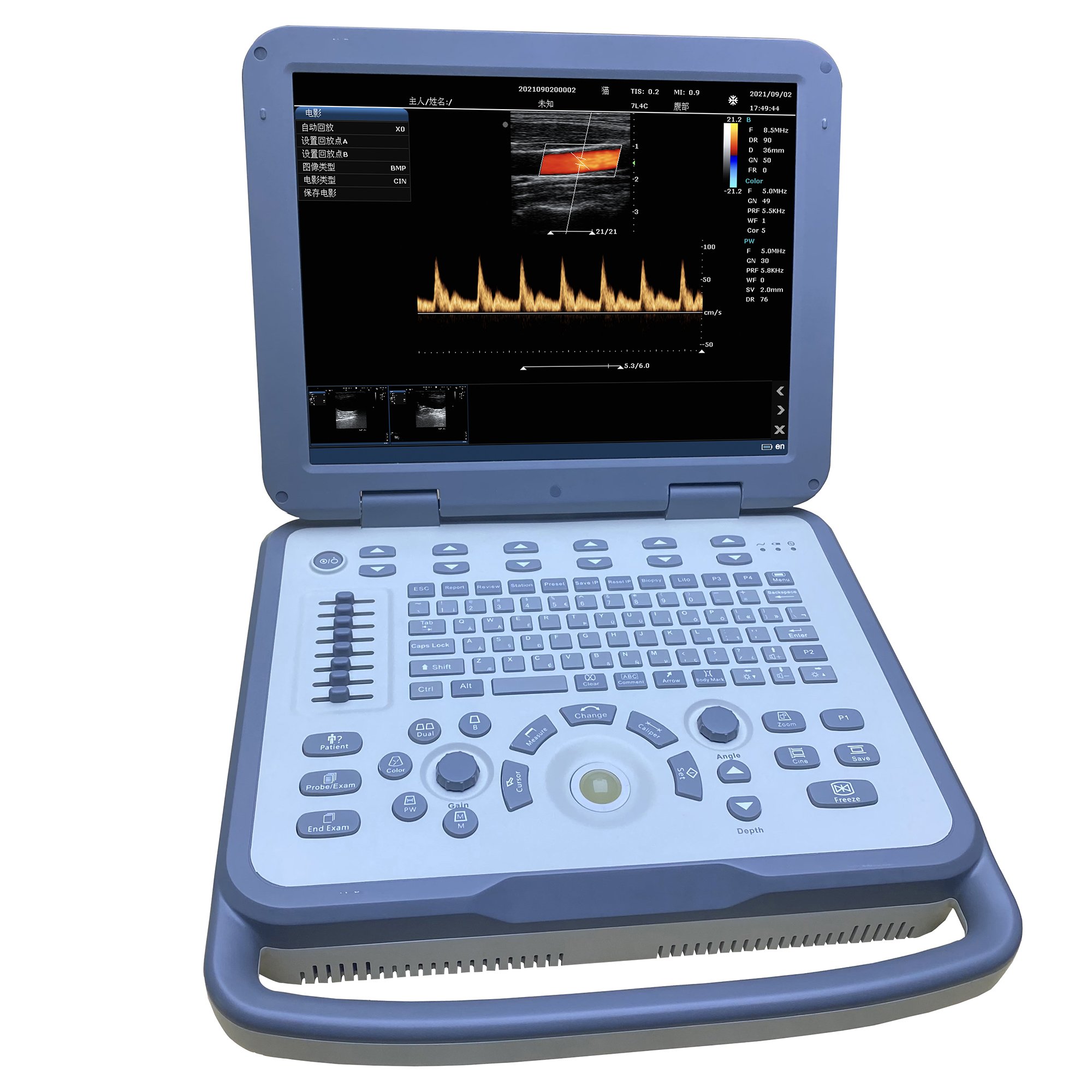 Medical Ultrasound Instruments Veterinary Digital Color Doppler Ultrasound Scanner System Ultrasound Machine