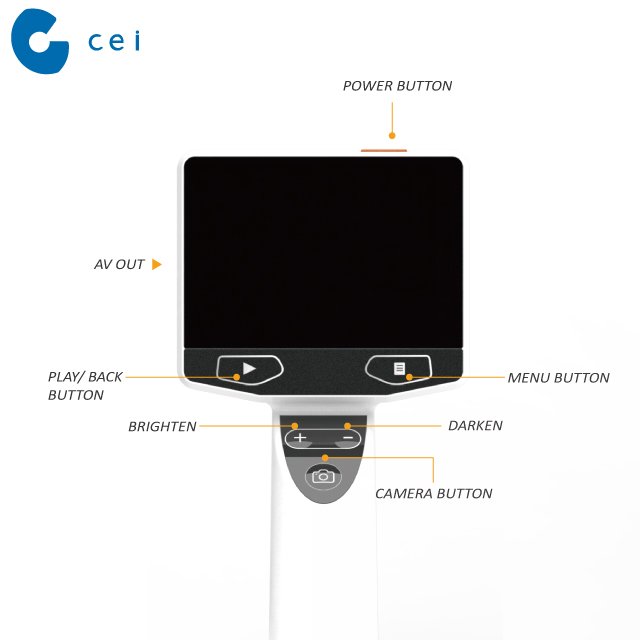 HD High Resolution Digital Video Otoscope Veterinary Medical Clinic Equipment