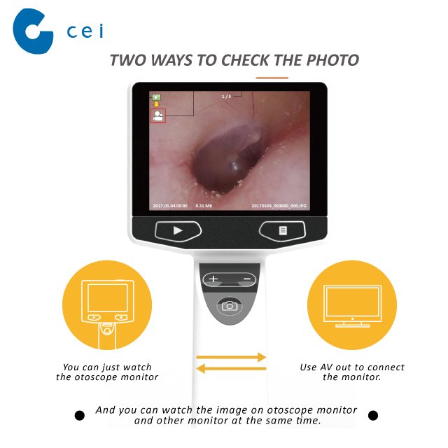 HD High Resolution Digital Video Otoscope Veterinary Medical Clinic Equipment
