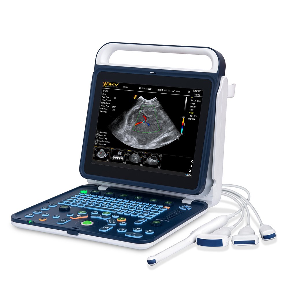 15 Inch High Resolution Doppler Vet Smart Ultrasound Machine for Equine