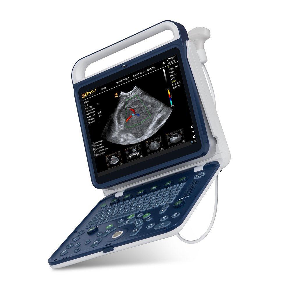 15 Inch High Resolution Doppler Vet Smart Ultrasound Machine for Equine
