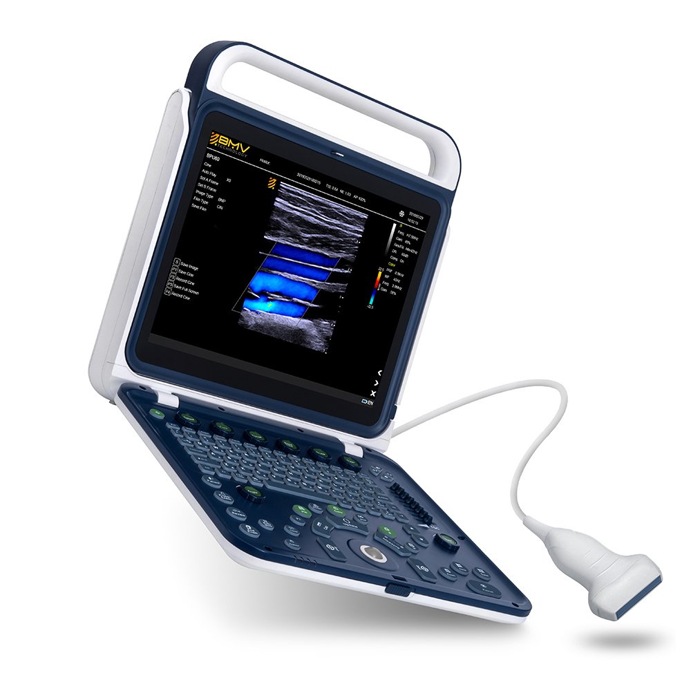15 Inch High Resolution Doppler Vet Smart Ultrasound Machine for Equine