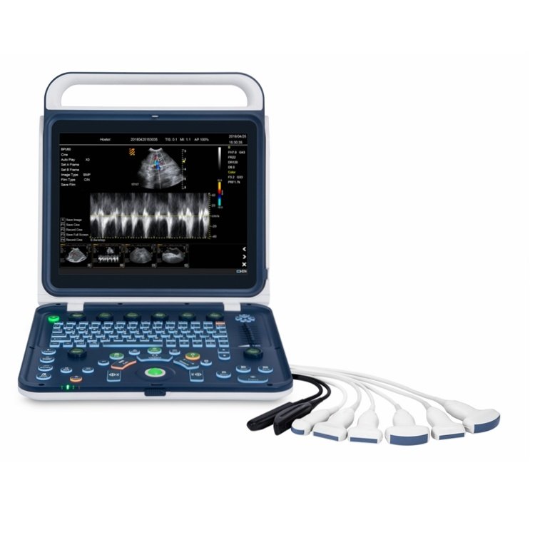 15 Inch High Resolution Doppler Vet Smart Ultrasound Machine for Equine