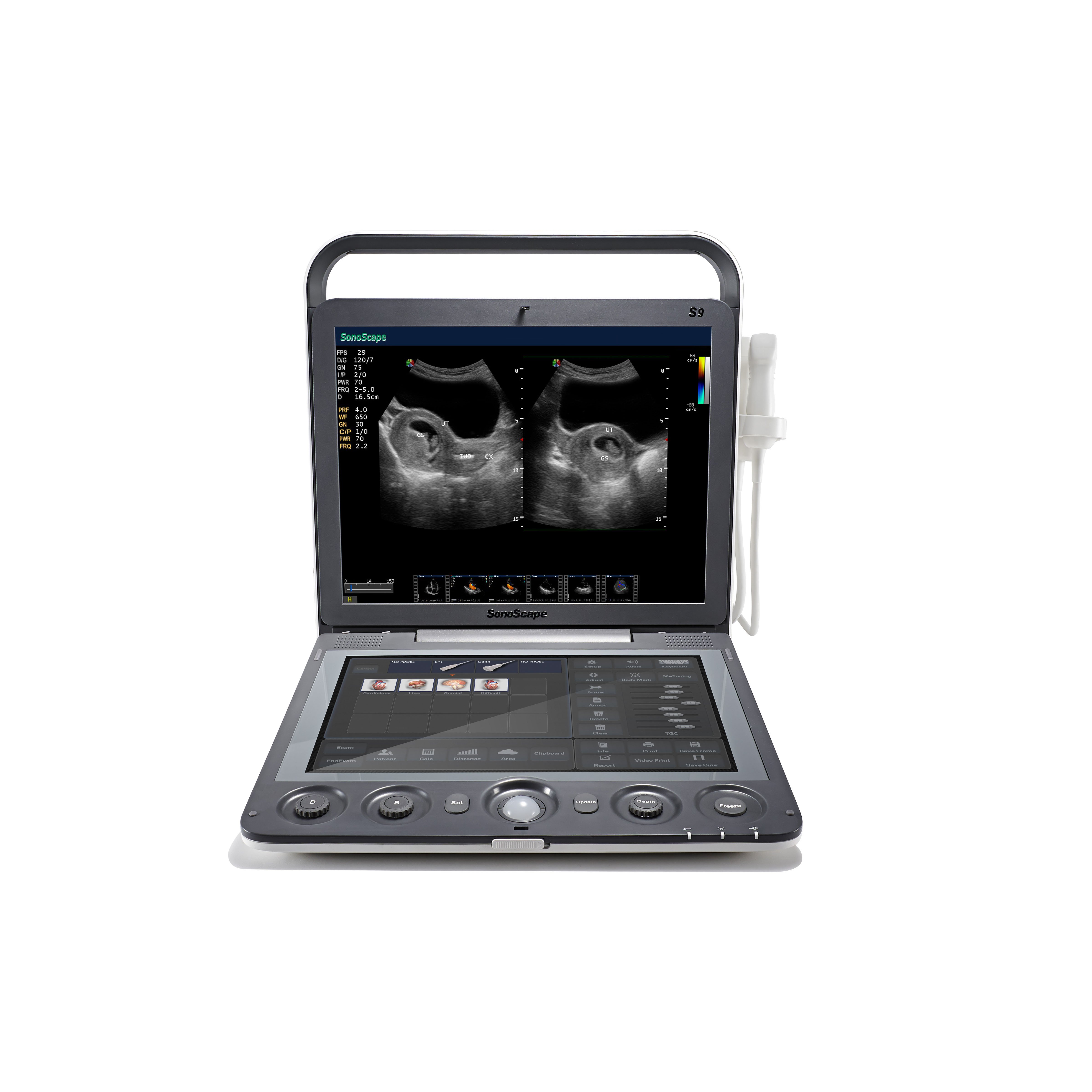 The ultrasound machine portable medical ultrasound instruments echographe sonoscape s9.