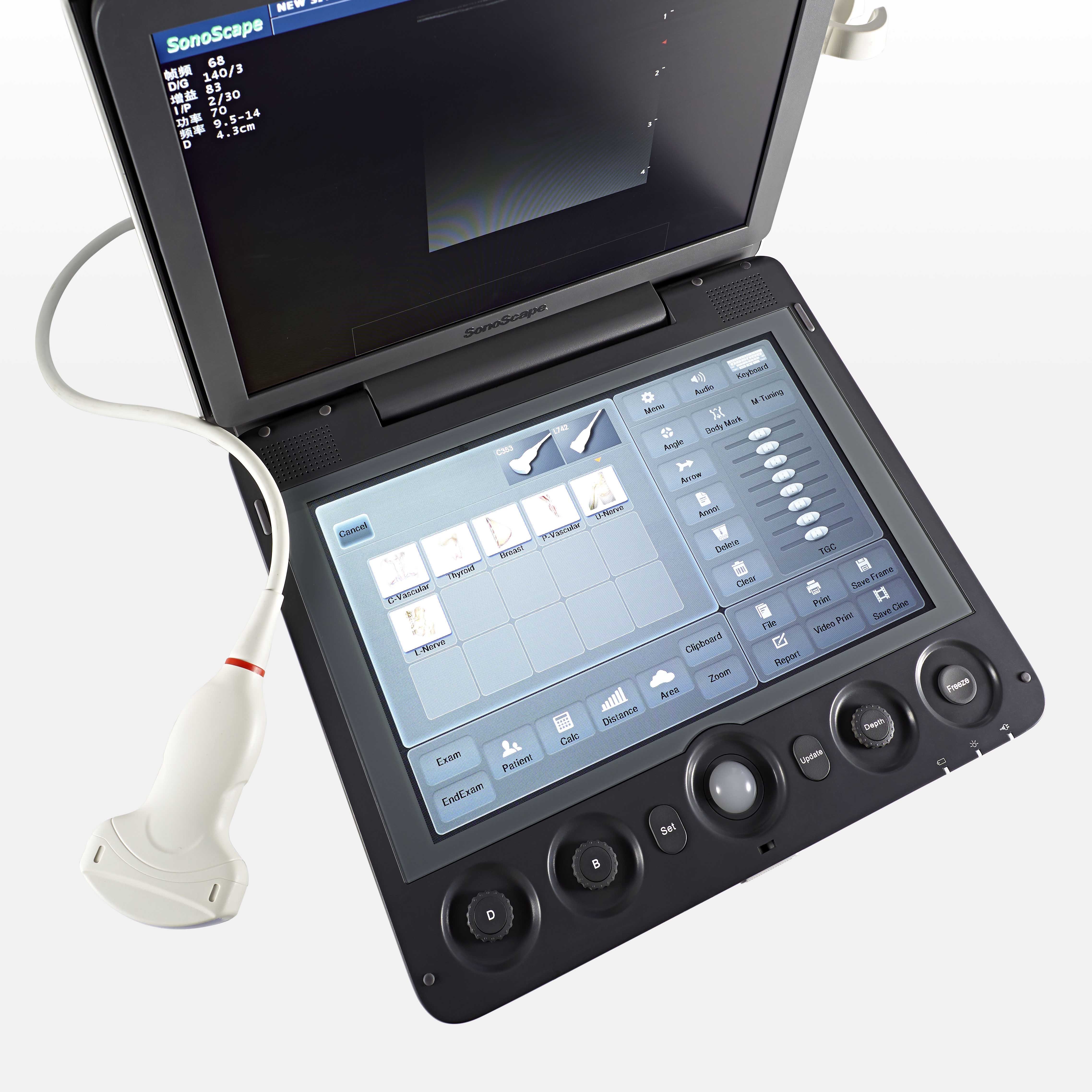 The ultrasound machine portable medical ultrasound instruments echographe sonoscape s9.
