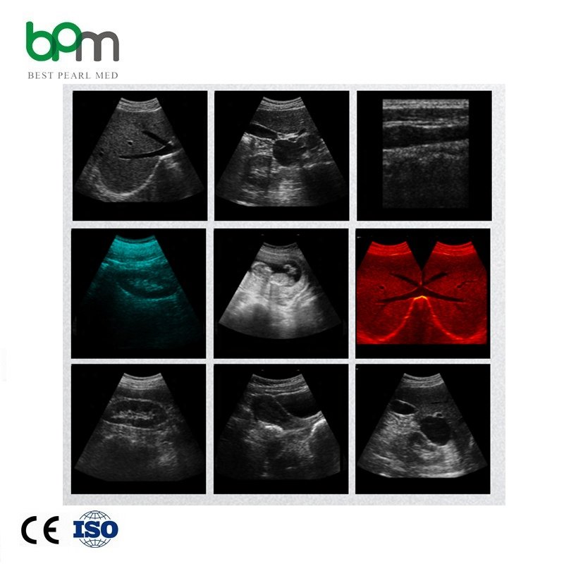 veterinary ultrasound portable color doppler medical ultrasound instruments vet 3d and 4dveterinary ultrasound