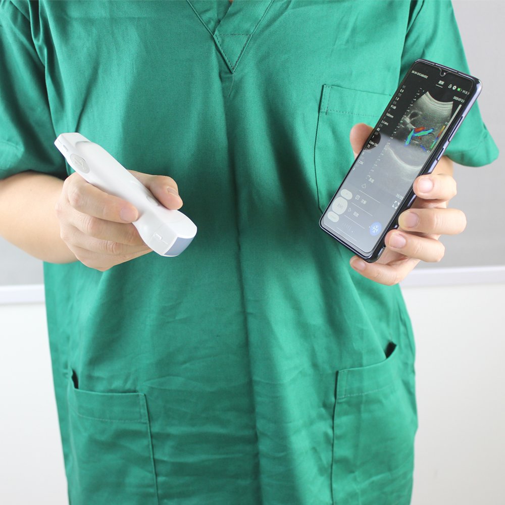 Newest Wireless Handheld Linear Doppler Ultrasound Probe 128 Elements Wifi Ultrasound Probe 14 Mhz MSK