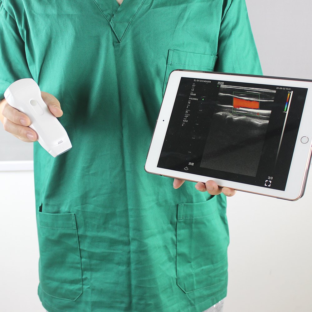 Newest Wireless Handheld Linear Doppler Ultrasound Probe 128 Elements Wifi Ultrasound Probe 14 Mhz MSK