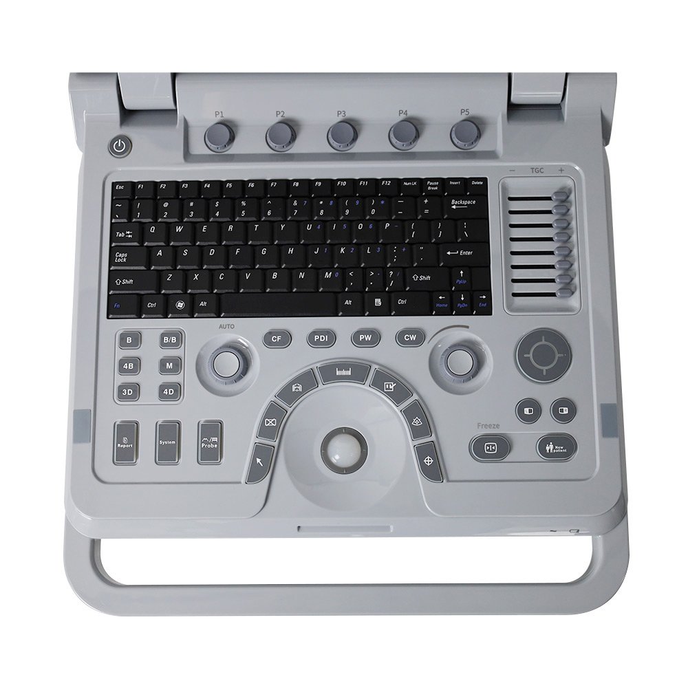 CONTEC CMS1700B color Doppler instrument portable ultrasound in 3d and 4d ultrasound sensor