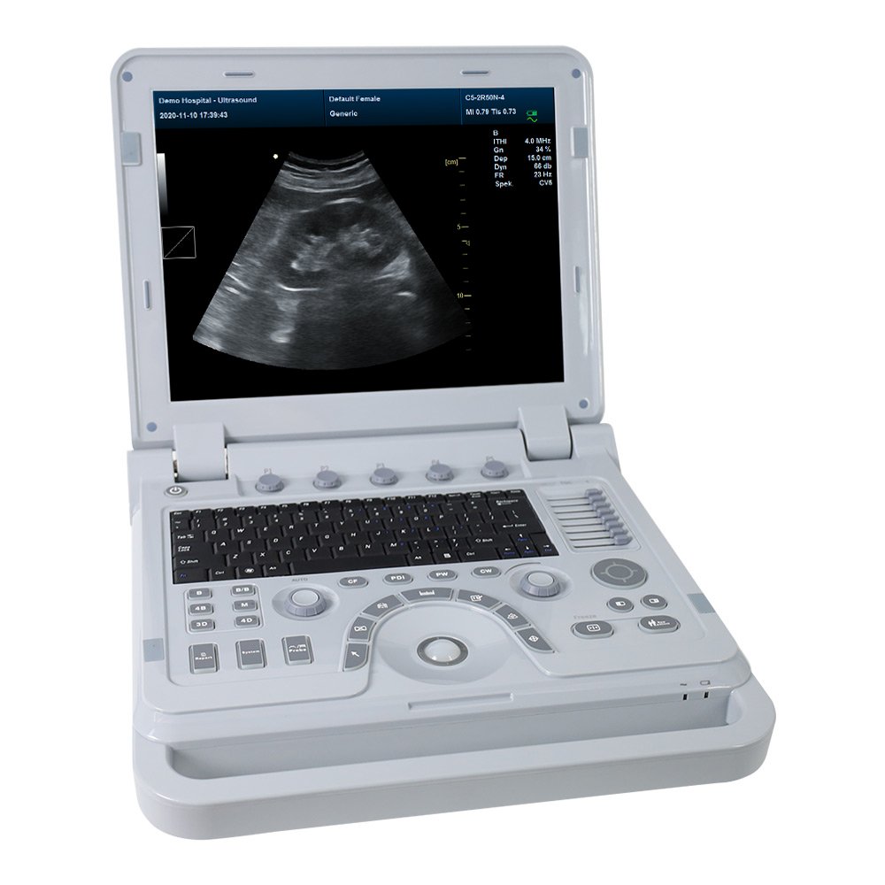 CONTEC CMS1700B color Doppler instrument portable ultrasound in 3d and 4d ultrasound sensor