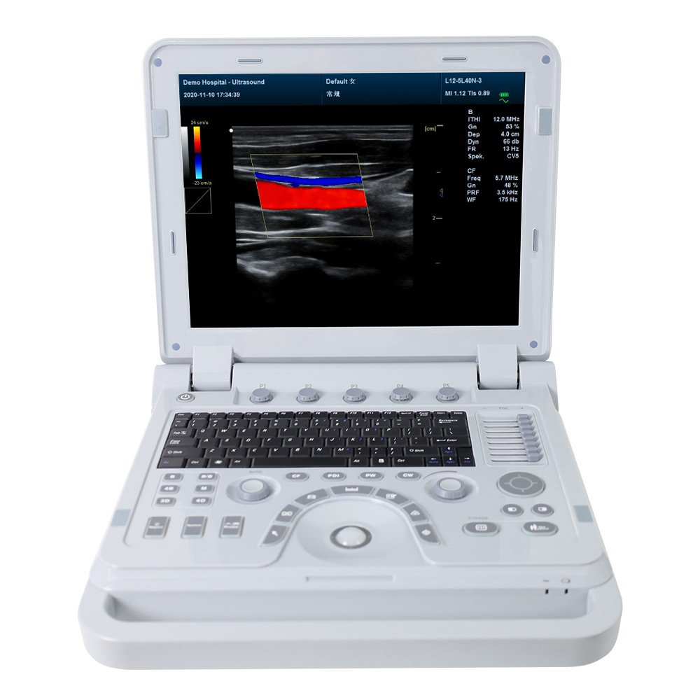 CONTEC CMS1700A color ultrasound instrument portable ultrasound machine