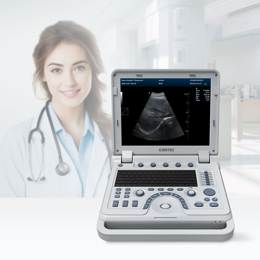 CONTEC CMS1700A color ultrasound instrument portable ultrasound machine