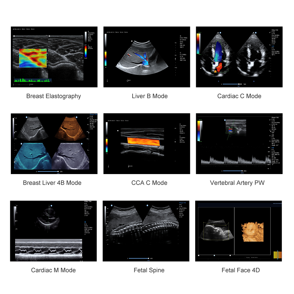 Medical animal veterinary instrument ultrasound machine price for vet ultrasound pregnancy scanner