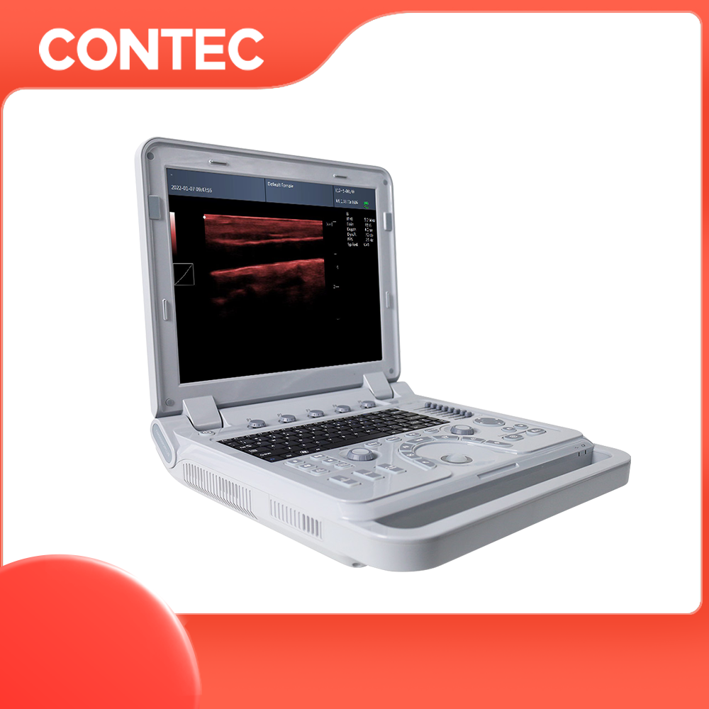 CONTEC CMS1700B portable ultrasound machine color doppler echocardiography medical ultrasound instruments