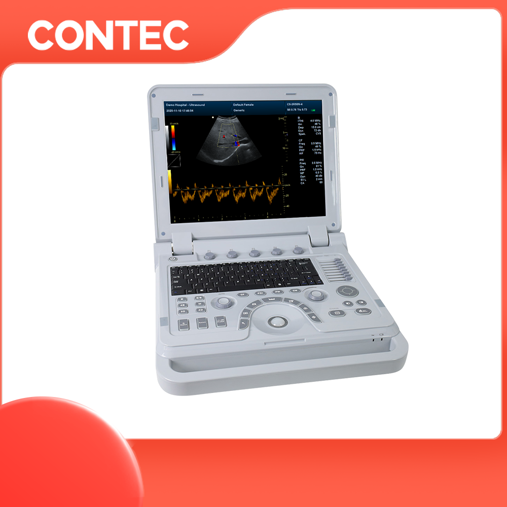 CONTEC CMS1700B portable ultrasound machine color doppler echocardiography medical ultrasound instruments