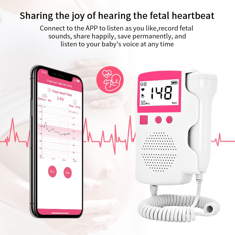 Hot Sale Medical Ultrasound Instruments High Sensitivity Adjustable 3Mhz Real-time FHR Medical Fetal Doppler With App