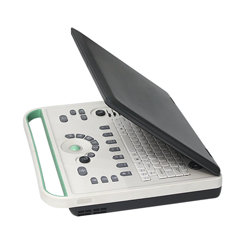 MN-Ultra1 Basic B Ultrasound Full Digital Ultrasound Diagnostic Instrument With 15 Inch High Resolution Medical LCD Display