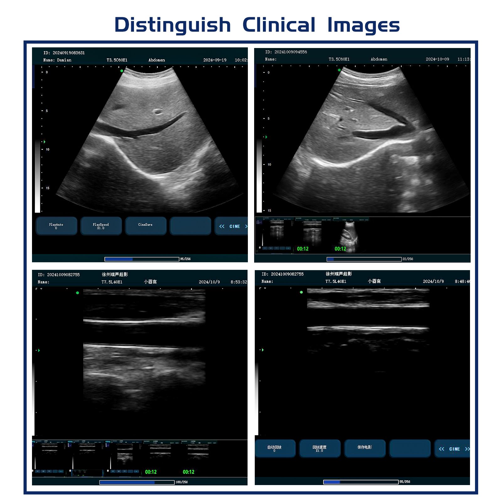 Human Use Medical 2d BW Ultrasound Instruments Black And White Ultrasound Machine