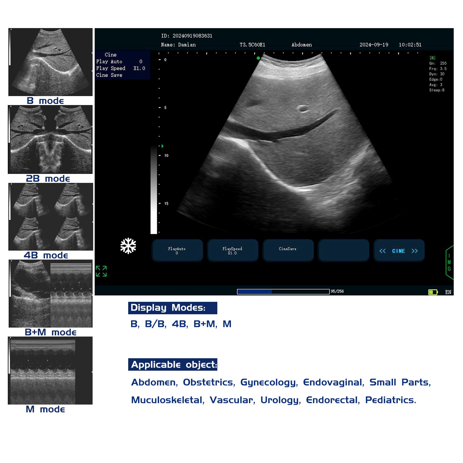 Human Use Medical 2d BW Ultrasound Instruments Black And White Ultrasound Machine