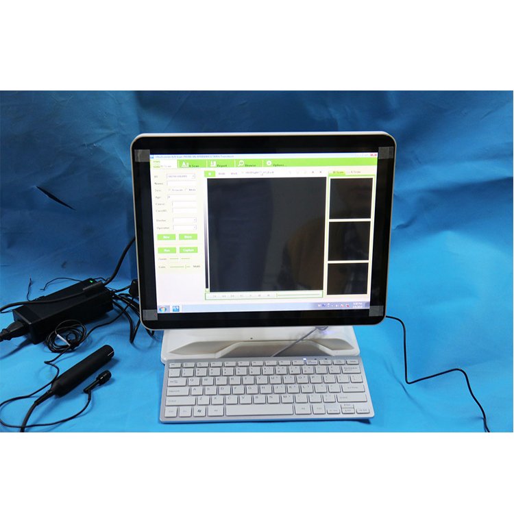 Medical Ophthalmology Instrument Touch Screen Eye Examination Ophthalmic A/B Ultrasound Scanner
