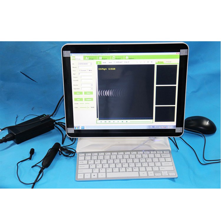 Medical Ophthalmology Instrument Touch Screen Eye Examination Ophthalmic A/B Ultrasound Scanner
