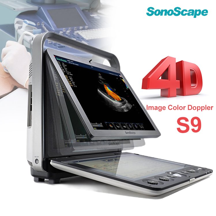 medical ultrasound instruments SonoScape S9 4D portable color doppler ultrasound machine price