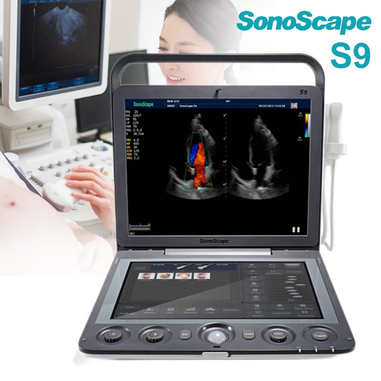 medical ultrasound instruments SonoScape S9 4D portable color doppler ultrasound machine price