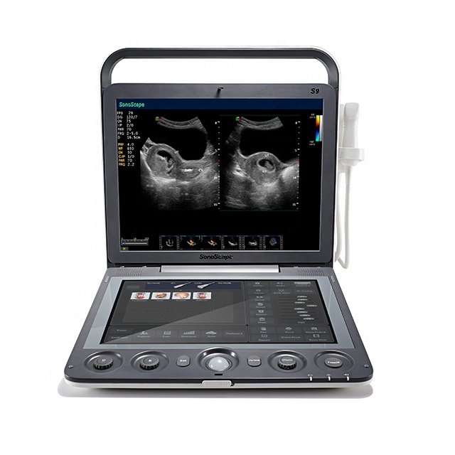 medical ultrasound instruments SonoScape S9 4D portable color doppler ultrasound machine price