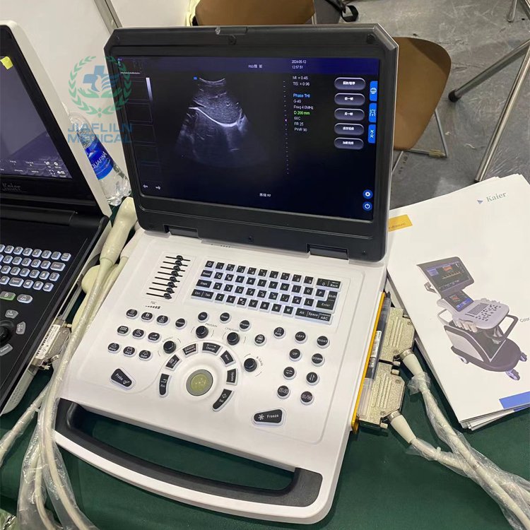 Portable Ultrasound Scanner Medical Ultrasound Instrument Color Doppler Ultrasound Machine