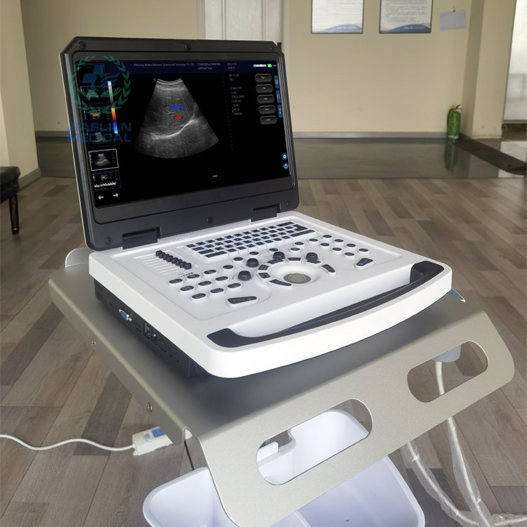 Portable Ultrasound Scanner Medical Ultrasound Instrument Color Doppler Ultrasound Machine