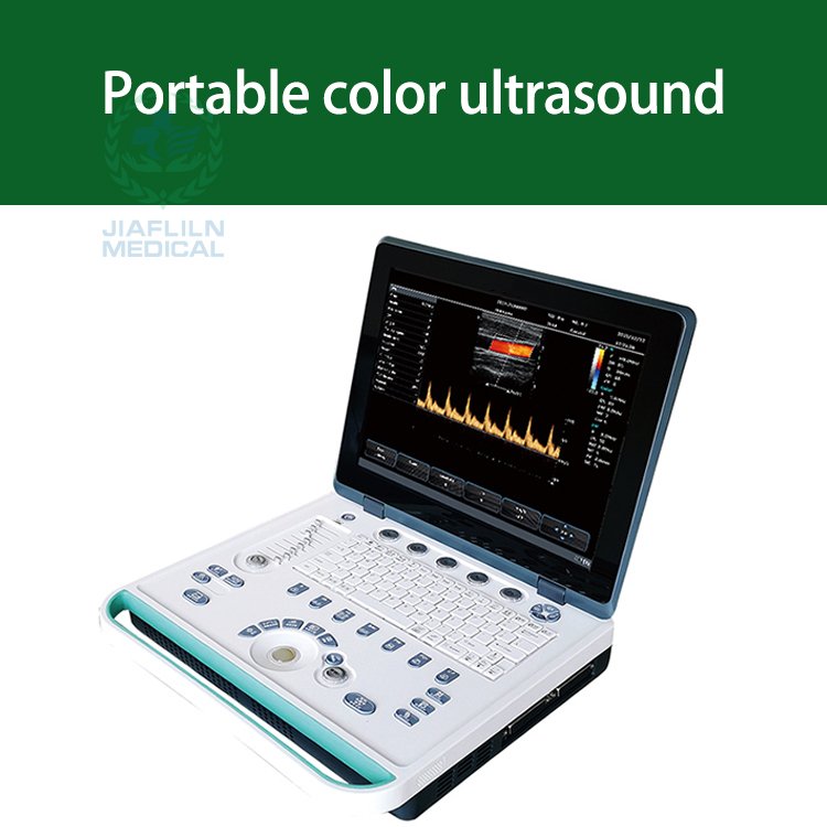 Doppler Portable 3D 4D Echocardiogram Ultrasound Machine