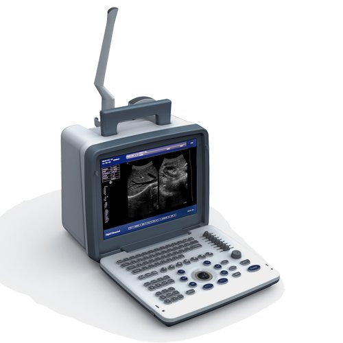 Medical Ultrasound Instruments Portable Equipos De Ultrasonido Ultrasound Machine For Human And Pets
