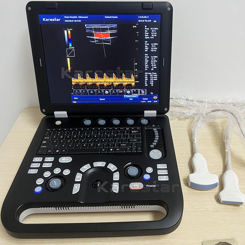 Animal Medical Ultrasound Instruments ultrasonido portatil Ultrasound Portable Color Doppler Ultrasound Machine