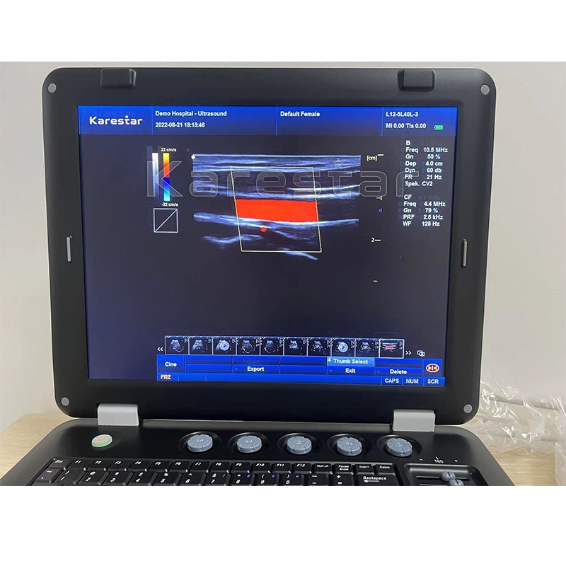 Animal Medical Ultrasound Instruments ultrasonido portatil Ultrasound Portable Color Doppler Ultrasound Machine