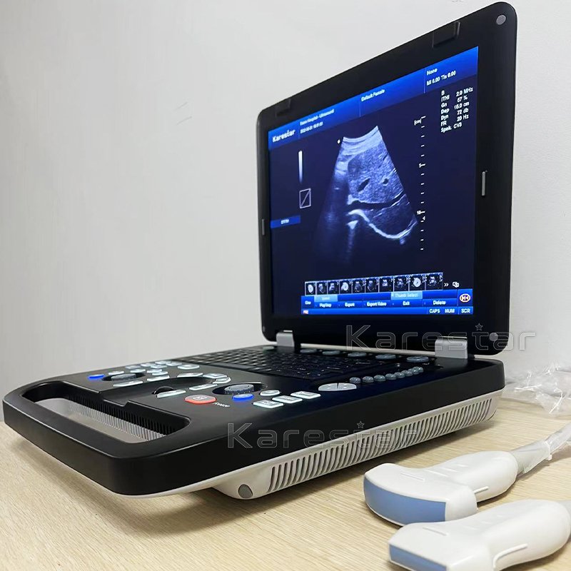 Animal Medical Ultrasound Instruments ultrasonido portatil Ultrasound Portable Color Doppler Ultrasound Machine