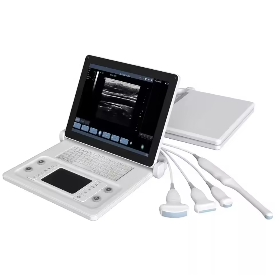 Hand Carried Laptop Medical Ultrasound Instruments Portable Doppler ultrasonic Scanner