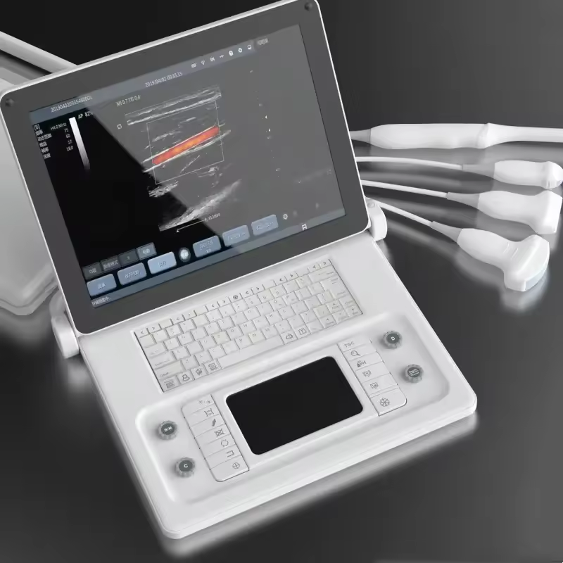 Hand Carried Laptop Medical Ultrasound Instruments Portable Doppler ultrasonic Scanner