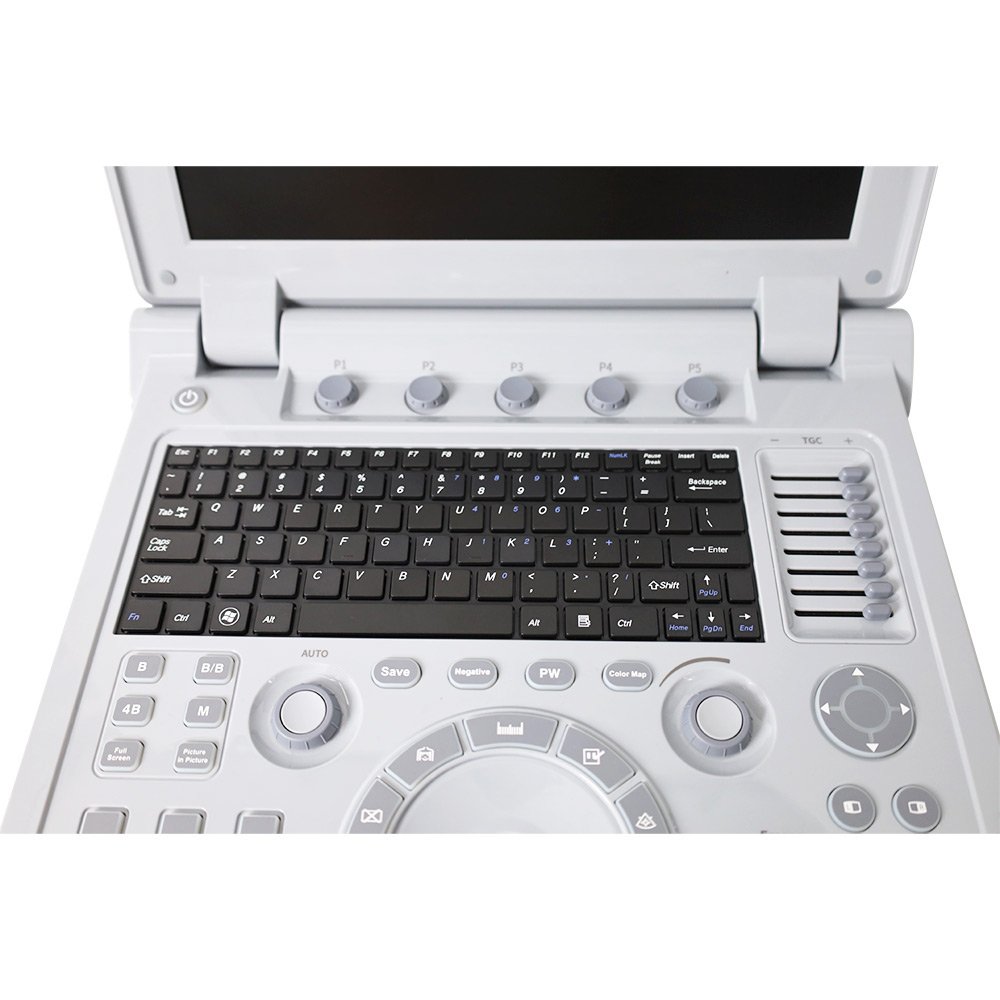 CONTEC CMS600P2PLUS-VET veterinary ultrasound b vet color doppler ultrasound machine portable doppler ultrasound