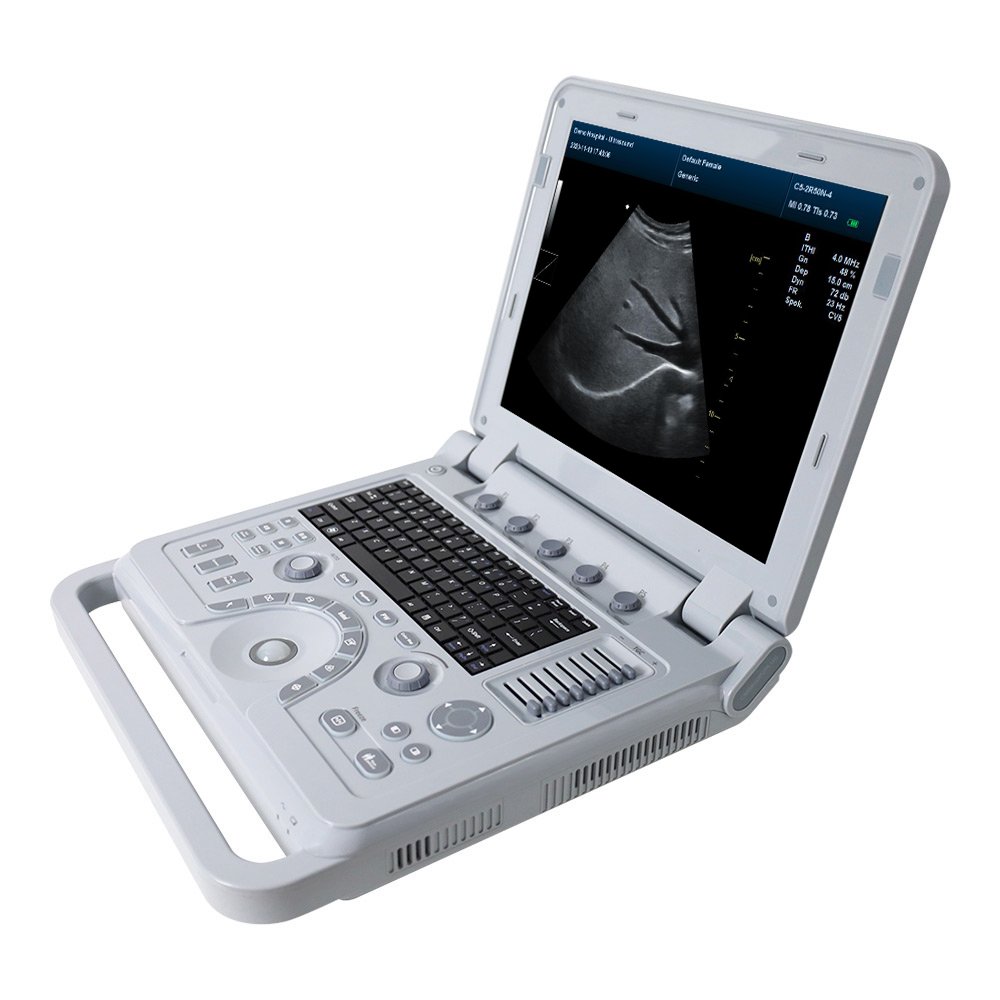 CONTEC CMS600P2PLUS-VET veterinary ultrasound b vet color doppler ultrasound machine portable doppler ultrasound