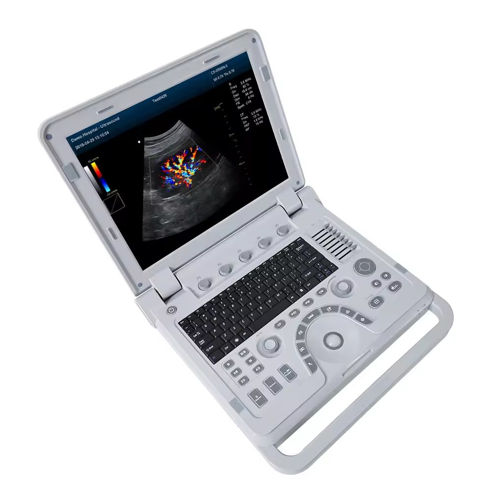 Veterinary equipment portable ultrasound scanner veterinary ultrasound machine
