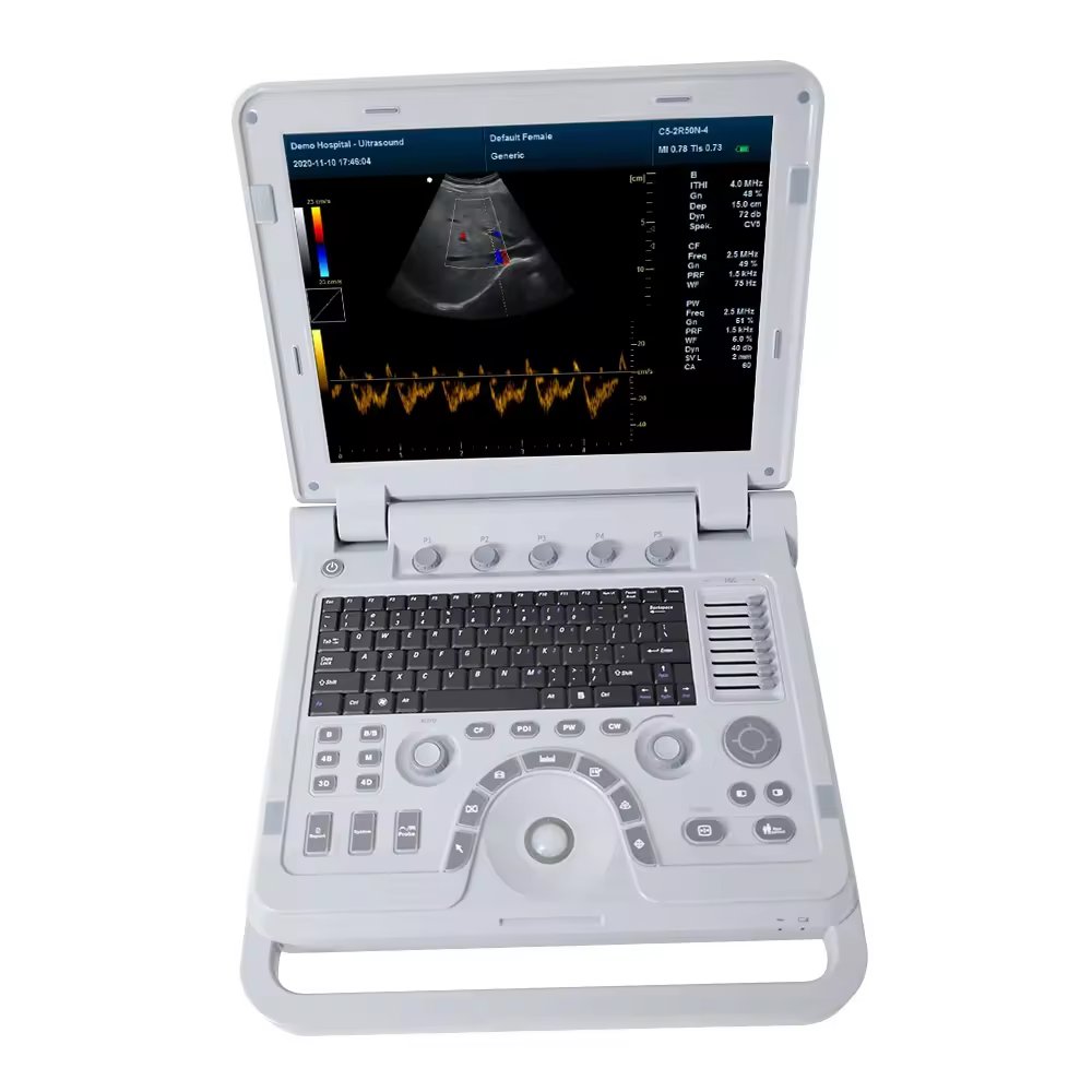 Veterinary equipment portable ultrasound scanner veterinary ultrasound machine